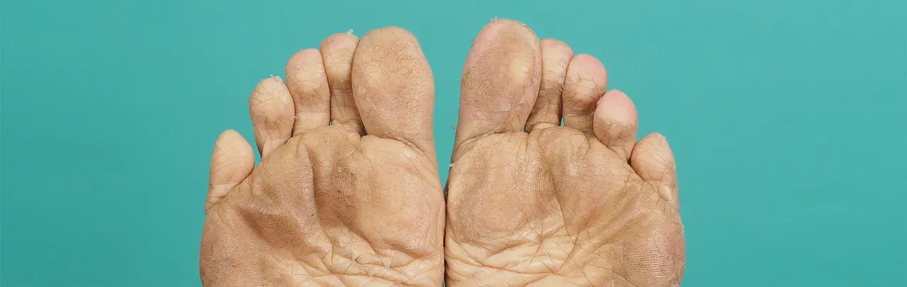 How to Care for Diabetic Feet